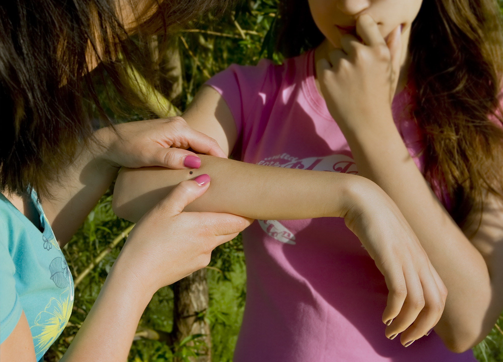 people looking at wood tick embedded in human skin